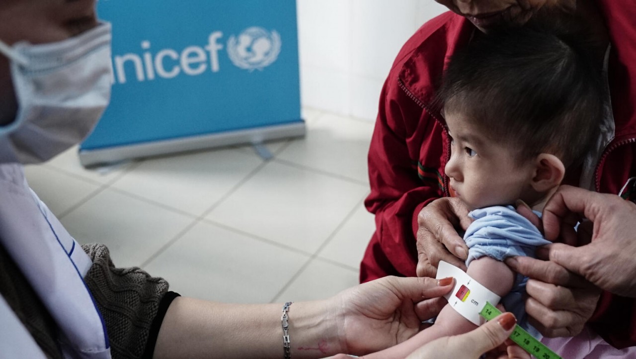 UNICEF kêu gọi các quốc gia tăng cường chính sách dinh dưỡng và tích hợp điều trị suy dinh dưỡng cấp tính ở trẻ em vào các chương trình y tế và ngân sách phát triển dài hạn. (Nguồn: UNICEF)